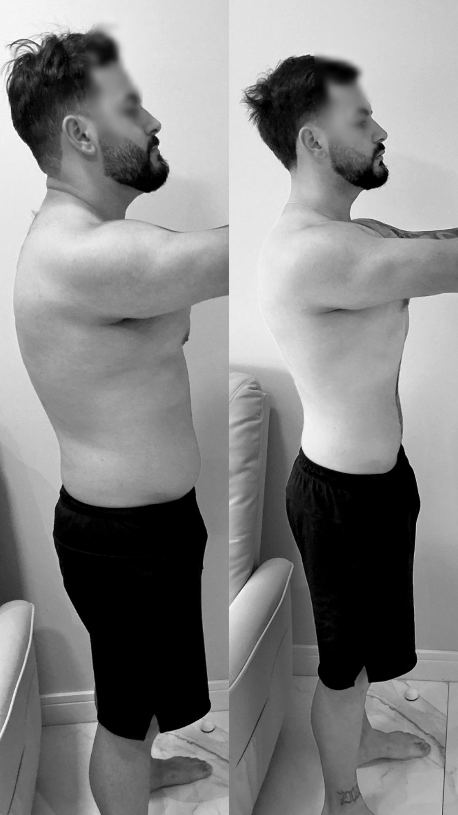 Paciente do Dr. Christian Chaves, antes e depois do acompanhamento de emagrecimento