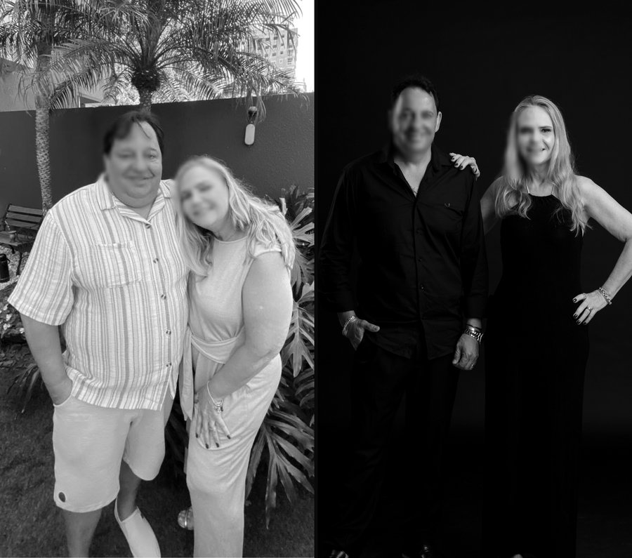 Casal, antes e depois do acompanhamento de emagrecimento com o Dr. Christian Chaves