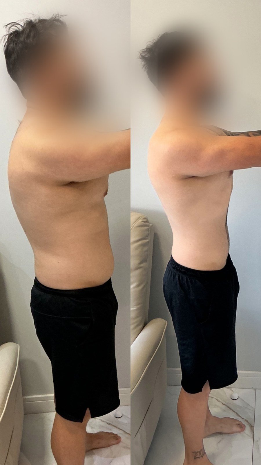 Paciente do Dr. Christian Chaves, antes e depois do acompanhamento de emagrecimento