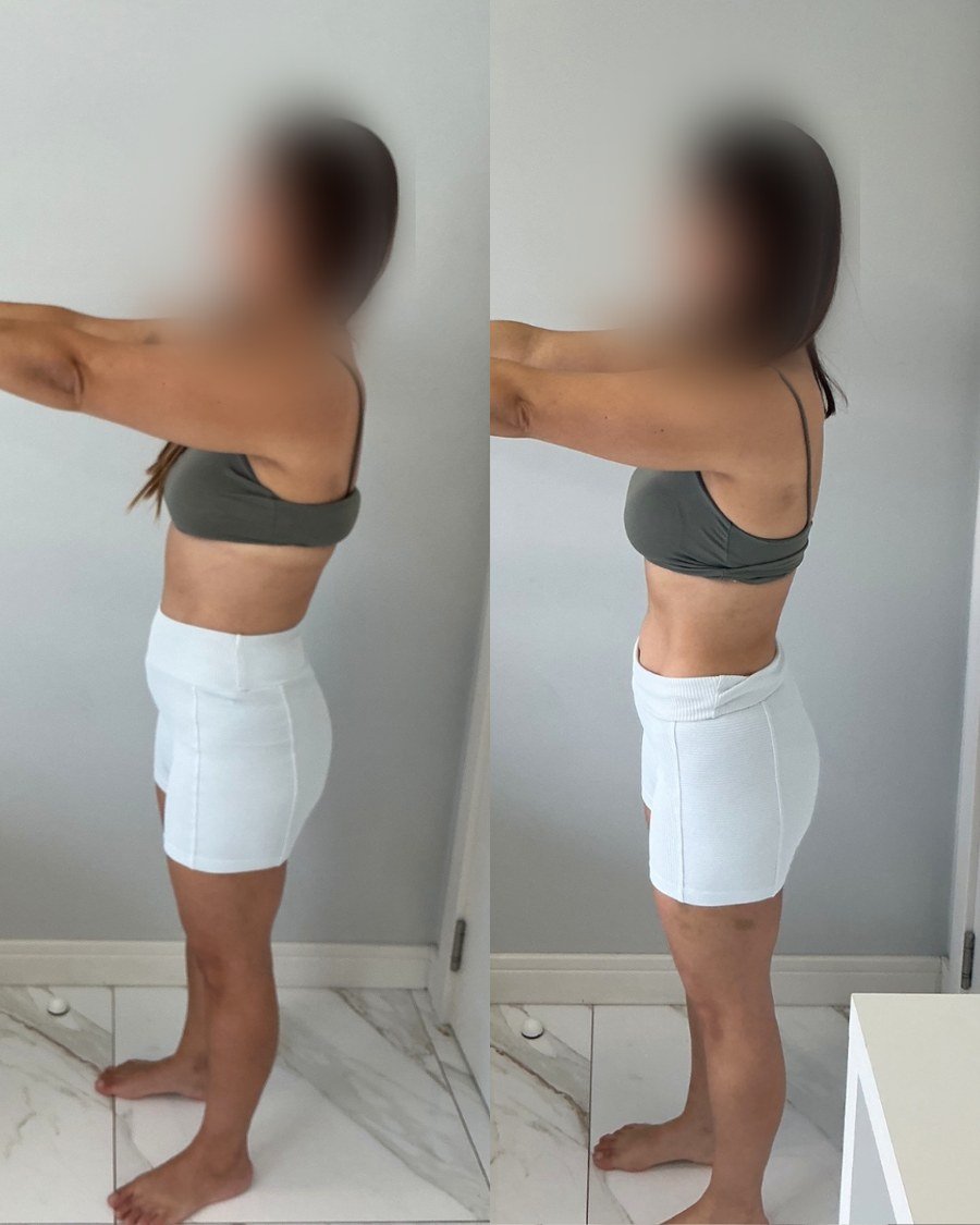 Paciente do Dr. Christian Chaves, antes e depois do acompanhamento de emagrecimento
